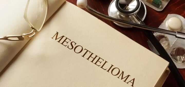 lawsuit for Mesothelioma